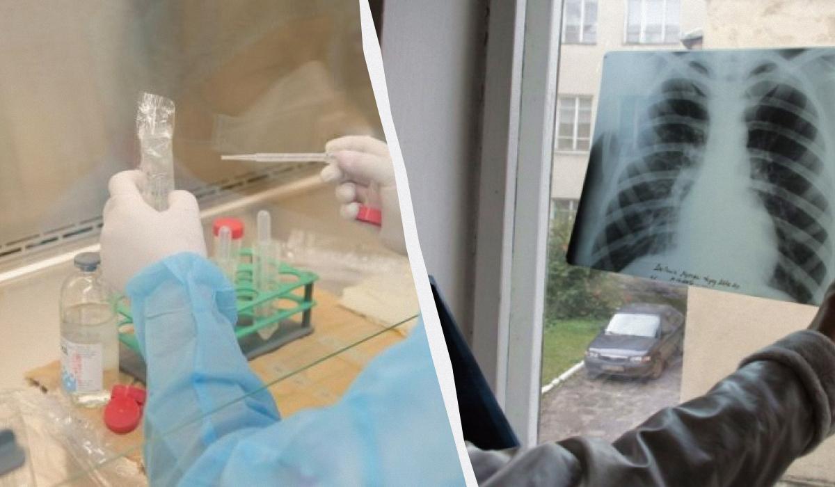 Проби Манту в Україні вже не буде: чим замінять