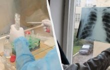 Пробы Манту в Украине больше не будет: чем заменят