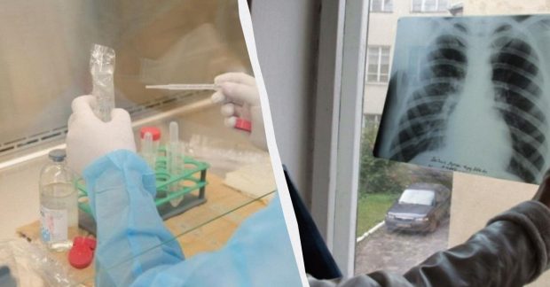 в Україні замінять пробу Манту іншим аналізом