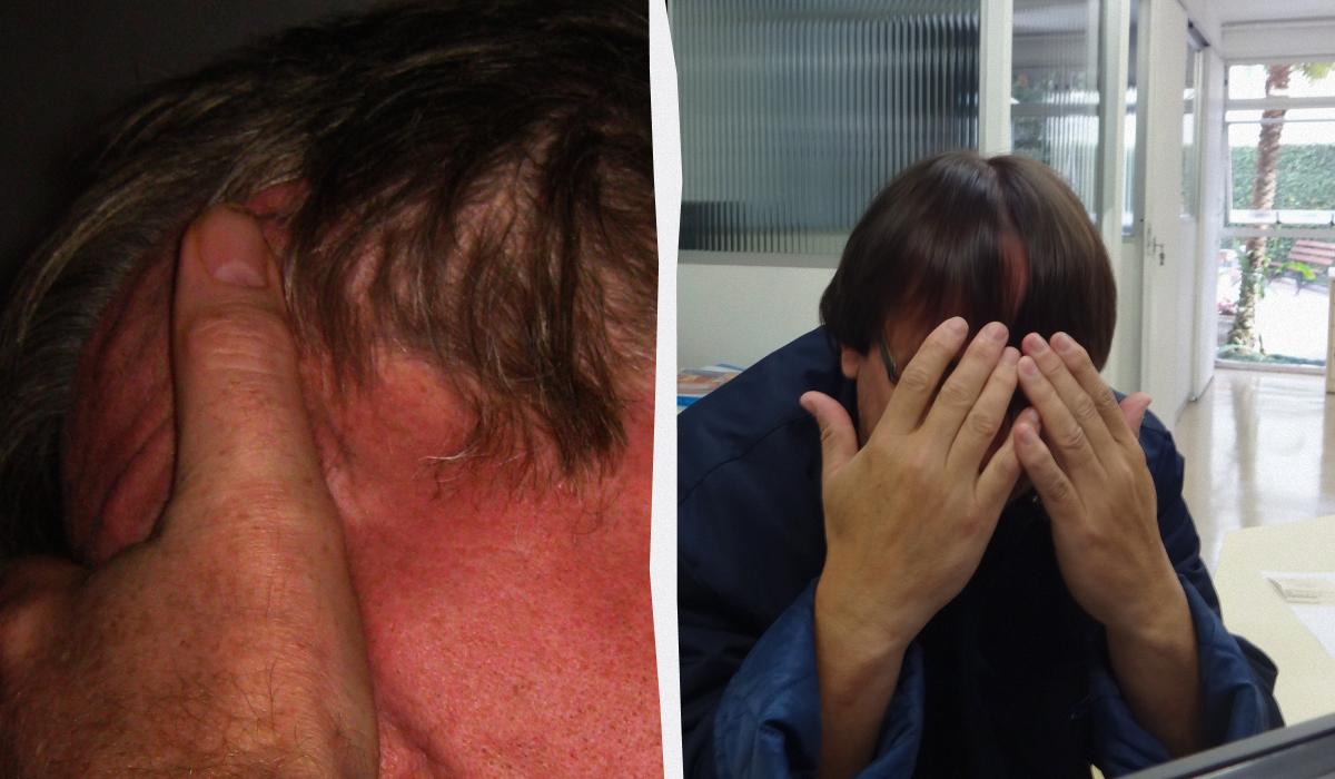 Зрада шкіри: чому еволюція навчила нас червоніти в найнезручніші моменти