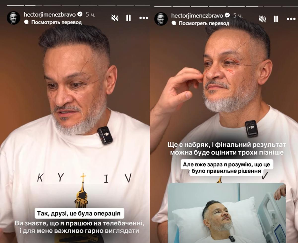 Судья 'МастерШеф' сделал пластическую операцию (фото) Судья 'МастерШеф' сделал пластическую операцию (фото)