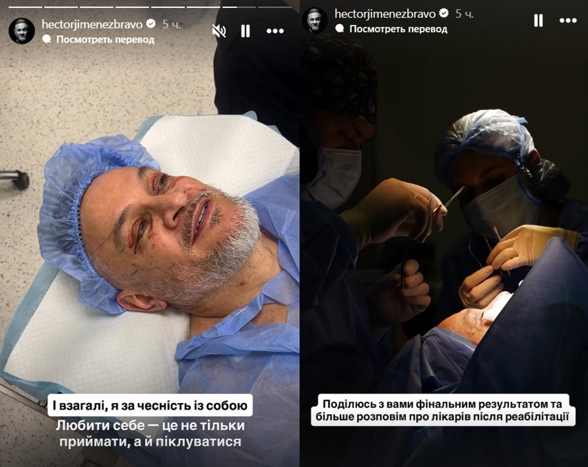 Судья 'МастерШеф' сделал пластическую операцию (фото) Судья 'МастерШеф' сделал пластическую операцию (фото)