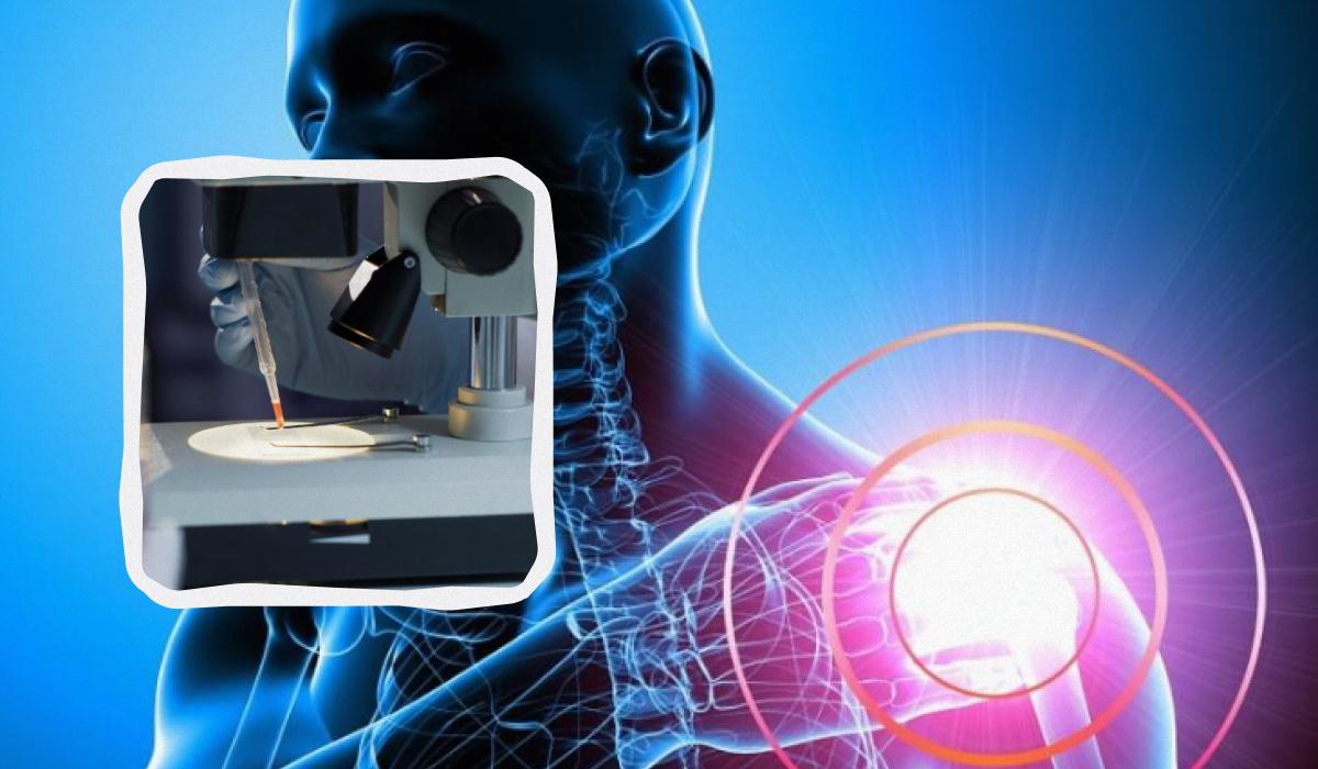 Відкриття німецьких вчених може зупинити розвиток остеопорозу