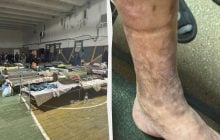 Незаконне утримання, антисанітарія, ігнорування хвороб: Лубінець показав Ужгородський ТЦК