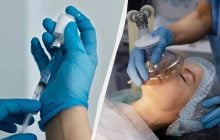 Чому не можна пити і їсти перед наркозом: що ще заборонено