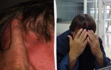 Зрада шкіри: чому еволюція навчила нас червоніти в найнезручніші моменти