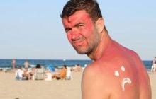 Нове дослідження перевернуло уявлення про те, як насправді виникають сонячні опіки