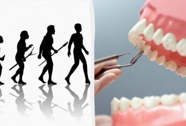 Вчені з'ясували, як зуби мудрості пов'язані з розвитком інтелекту: навіщо вони потрібні