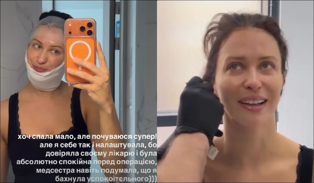 Відома українська акторка зробила пластичну операцію та показала результат (фото) Відома українська акторка зробила пластичну операцію та показала результат (фото)