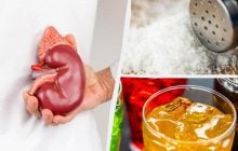 Диетологи назвали 7 популярных продуктов, которые незаметно разрушают почки
