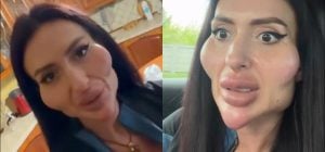 Украинка, которая избавляется от огромнейших скул, поразила заявлением о сроках