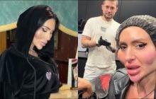 Українка з величезними вилицями показала, як уже місяць їх позбувається: мережа вражена