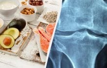 Що їсти для зміцнення кісток: дієтологи назвали 13 найкращих продуктів