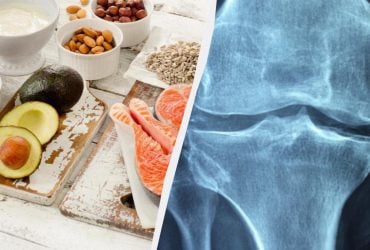 Що їсти для зміцнення кісток: дієтологи назвали 13 найкращих продуктів