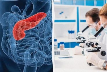 Ученые нашли способ уничтожить до 90 % клеток одного из самых агрессивных видов рака