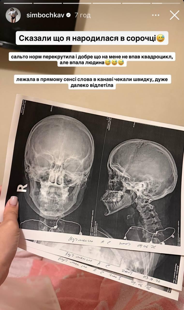 'Меня зашили, кости целы': популярная украинская блогерша попала в аварию 'Меня зашили, кости целы': популярная украинская блогерша попала в аварию