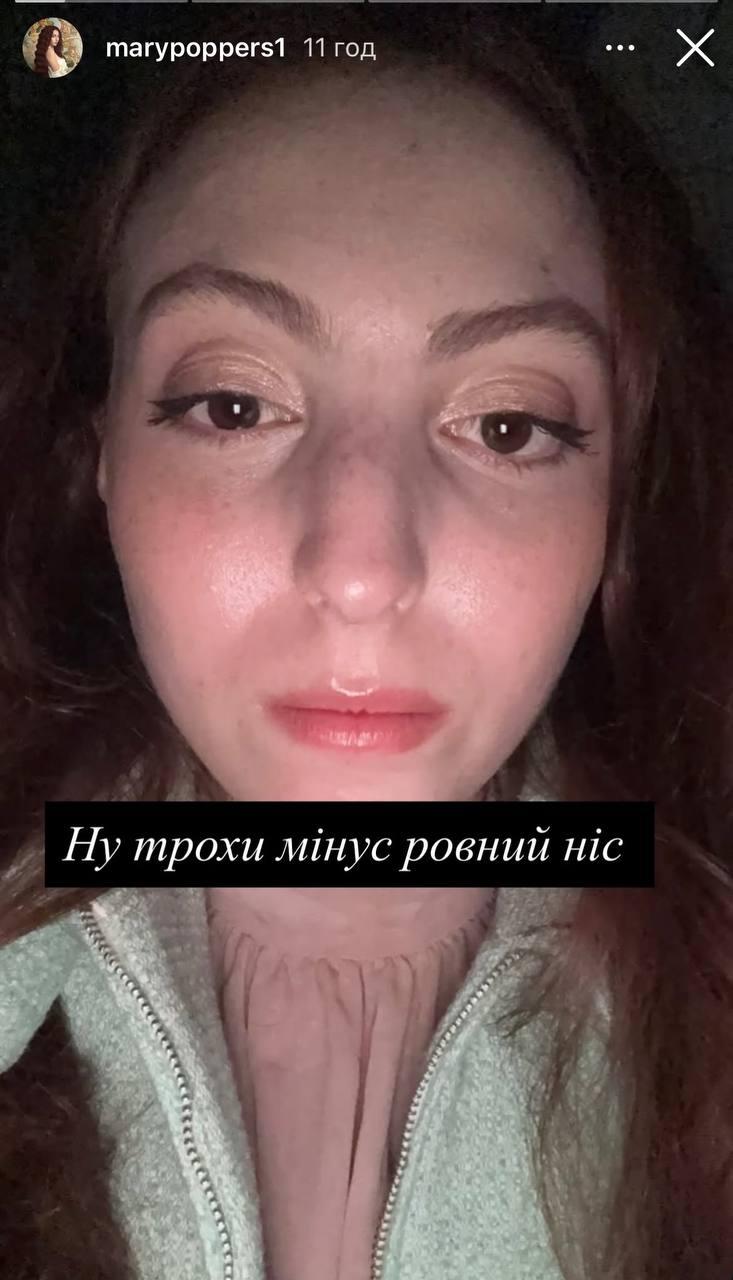 'Мінус рівний ніс': донька Полякової показала травми після ДТП (фото) 'Мінус рівний ніс': донька Полякової показала травми після ДТП (фото)