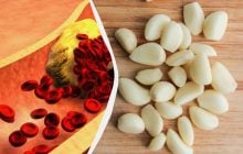 Що буде з холестерином, якщо їсти більше часнику: названо 5 можливих ефектів
