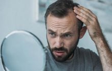 Важно, где именно вы лысеете: что линия волос может рассказать о вашем здоровье