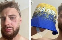 В Чехії побили поляка, якого прийняли за українця через кольори на панамці
