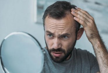 Важно, где именно вы лысеете: что линия волос может рассказать о вашем здоровье