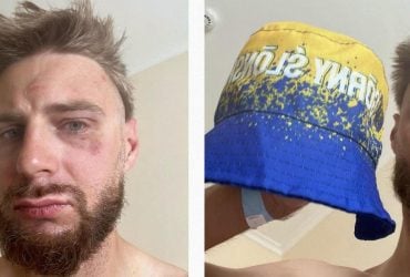 В Чехии избили поляка, которого приняли за украинца из-за цвета его панамки