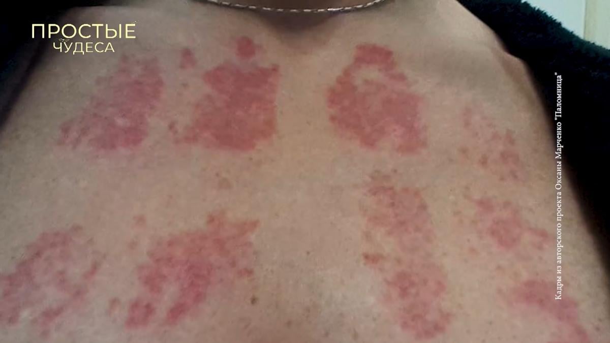Зрадниця Оксана Марченка заявила про 'божественне' зцілення від загадкових ран (фото) Зрадниця Оксана Марченка заявила про 'божественне' зцілення від загадкових ран (фото)
