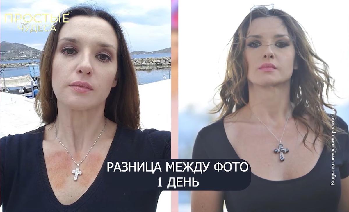 Зрадниця Оксана Марченка заявила про 'божественне' зцілення від загадкових ран (фото) Зрадниця Оксана Марченка заявила про 'божественне' зцілення від загадкових ран (фото)