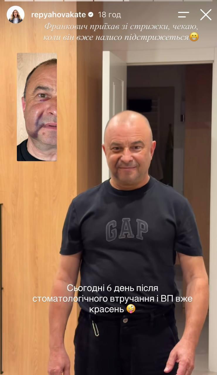 Дружина Павліка показала обличчя співака після операції та ускладнень (фото) Дружина Павліка показала обличчя співака після операції та ускладнень (фото)
