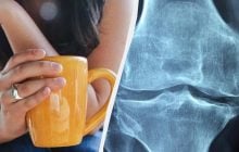 Кофе может вредить костям: ученые назвали количество чашек, которое не следует превышать